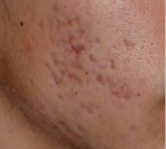 070257fee738f886f39cd8a7c1e51afe8776fdfd 070257fee738f886f39cd8a7c1e51afe8776fdfd