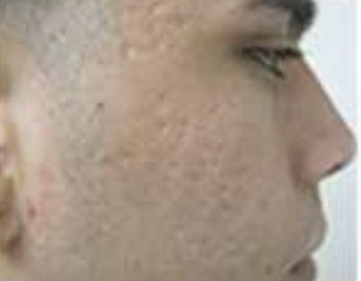 17e28c811829013d13198fc3bba43fde368b0d90