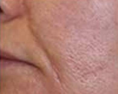 2b8d68c5e4a0e9f5e466e8d62f9fe53111f44ef3 2b8d68c5e4a0e9f5e466e8d62f9fe53111f44ef3