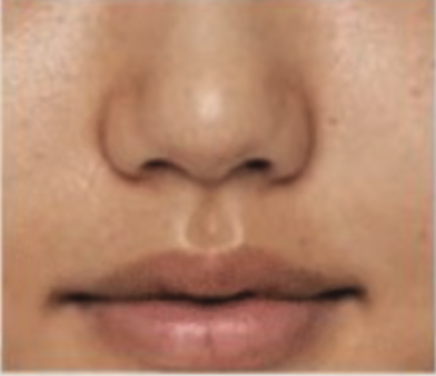 544cb5140eac377c852cb377a7449adec120c893 544cb5140eac377c852cb377a7449adec120c893