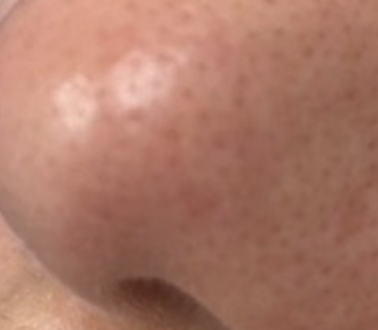 59a3ad09bd10333fef6ed51924d42acbe93f7a45