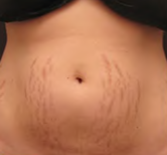 61ed5a269ae8922cc34bed2d7f36b8102377ae89 61ed5a269ae8922cc34bed2d7f36b8102377ae89