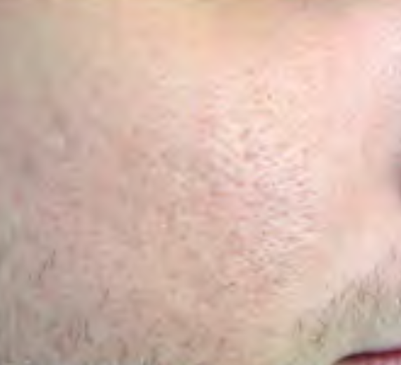 695a1ad2bd566d4ffabafc3900184fecf615cd79