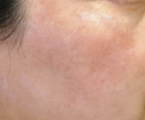 6992d35da50cf51e0acf1956dcaef5e65c3e01be