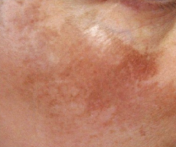 94e8e00b77b4b731b70e4e015b4659f3737313ca