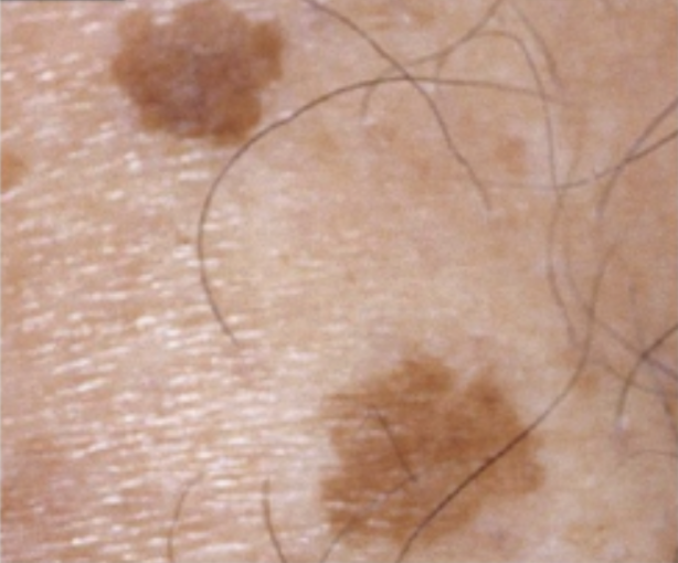 9f8dc11ebc3496bbb06eb6ba7ffbbc10bc61388e