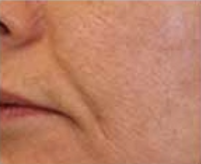 c40366b42e1decd2036f99d796a5c3134a3c6b3c