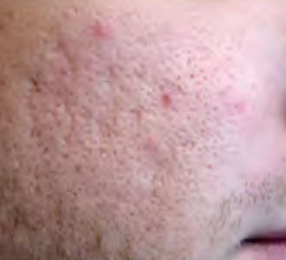 c8f2a6202925a0f7c8d3f0333c8b3d943f175969 c8f2a6202925a0f7c8d3f0333c8b3d943f175969