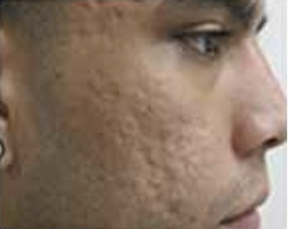 da016fa57f6c753b1f10efa94093da2a1a67335c da016fa57f6c753b1f10efa94093da2a1a67335c