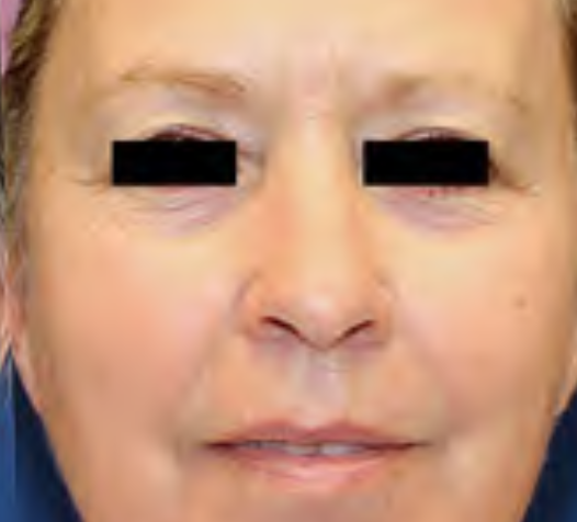 e230799fa66073aebf5c6cc1dcdf8ac522f72ecd