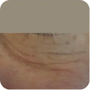 Rectangle 4 (3) Rectangle 4 (3)